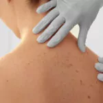 COSMETIC SURGERY COMPLICATIONS AND BENEFITS